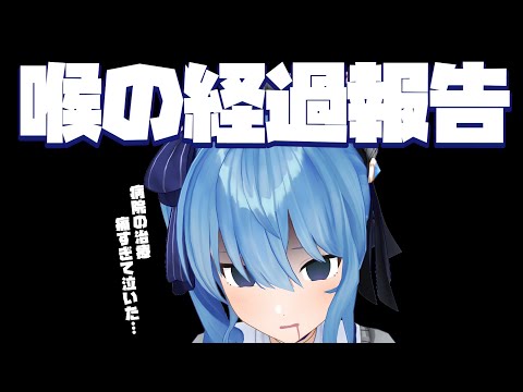 【雑談】病院の治療、痛すぎて泣いた話。【ホロライブ / 星街すいせい】